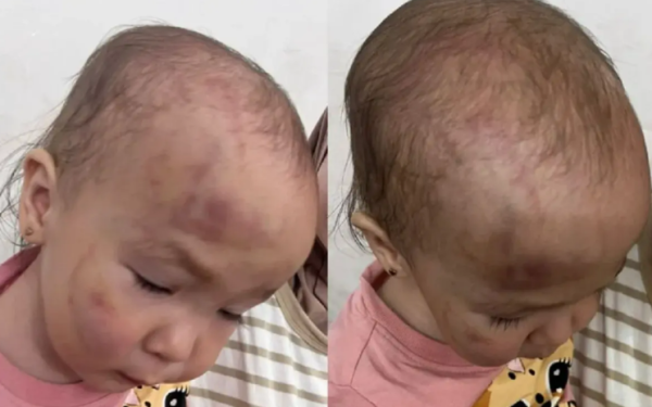 Мать избитого ребенка обвиняет следствие в бездействии в Актау
Мать избитого ребенка обвиняет следствие в бездействии в Актау