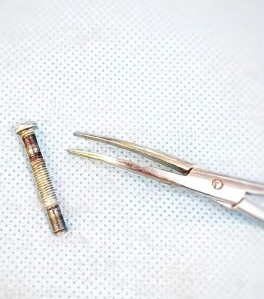 Малыша, проглотившего 4-сантиметровый болт, спасли в Туркестанской области
 
Малыша, проглотившего 4-сантиметровый болт, спасли в Туркестанской области