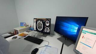 Аким области поручил усилить контроль за капитальным ремонтом Степногорской многопрофильной больницы Аким области поручил усилить контроль за капитальным ремонтом Степногорской многопрофильной больницы